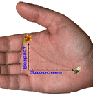Тайная женская болезнь Тайная женская болезнь